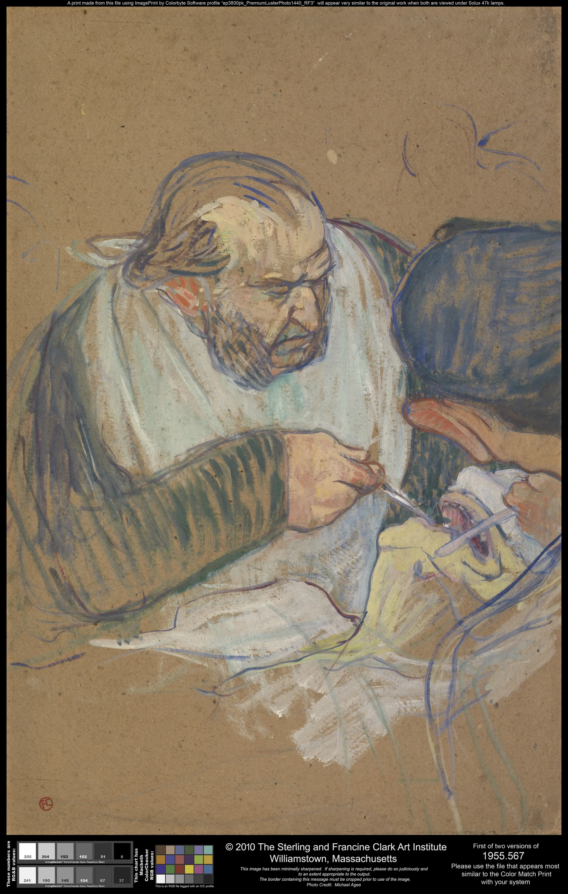 Dr. Péan Operating, Henri de Toulouse-Lautrec