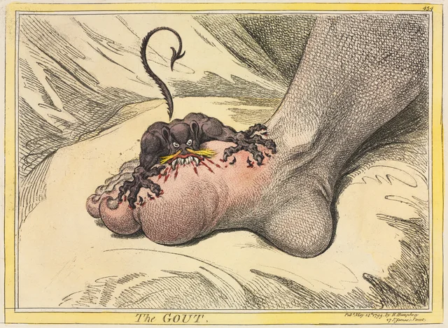 La gota, James Gillray