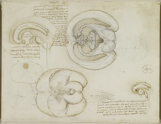 Studies of the Shape and Size of the Cerebral Ventricles